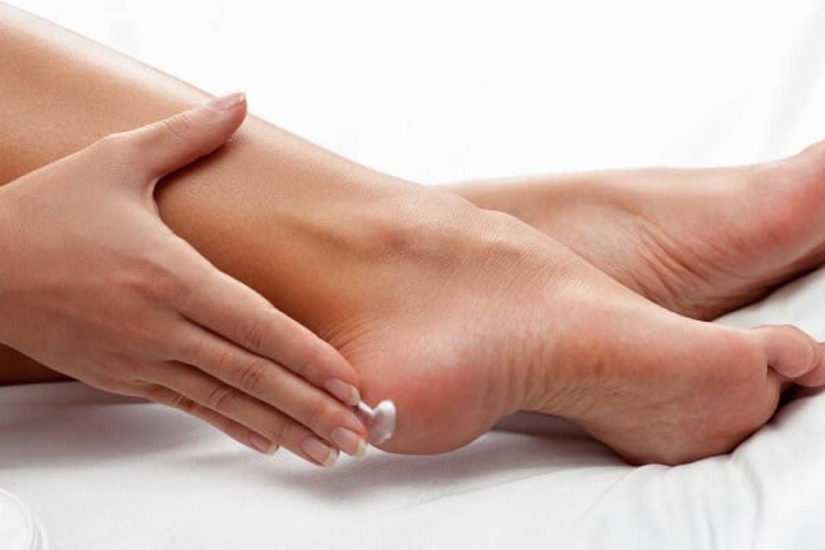 Kem trị nứt nẻ gót chân