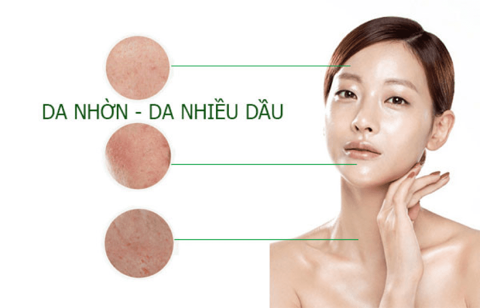 hình ảnh mô tả da dầu mụn 