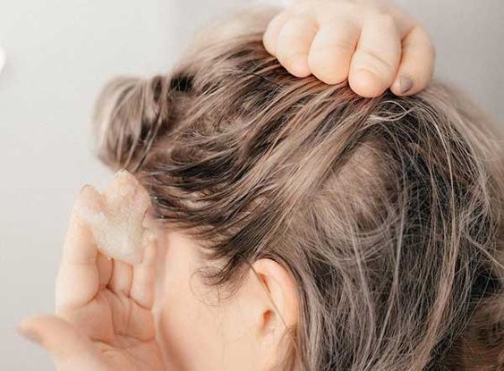 Tẩy tế bào chết cho da dầu